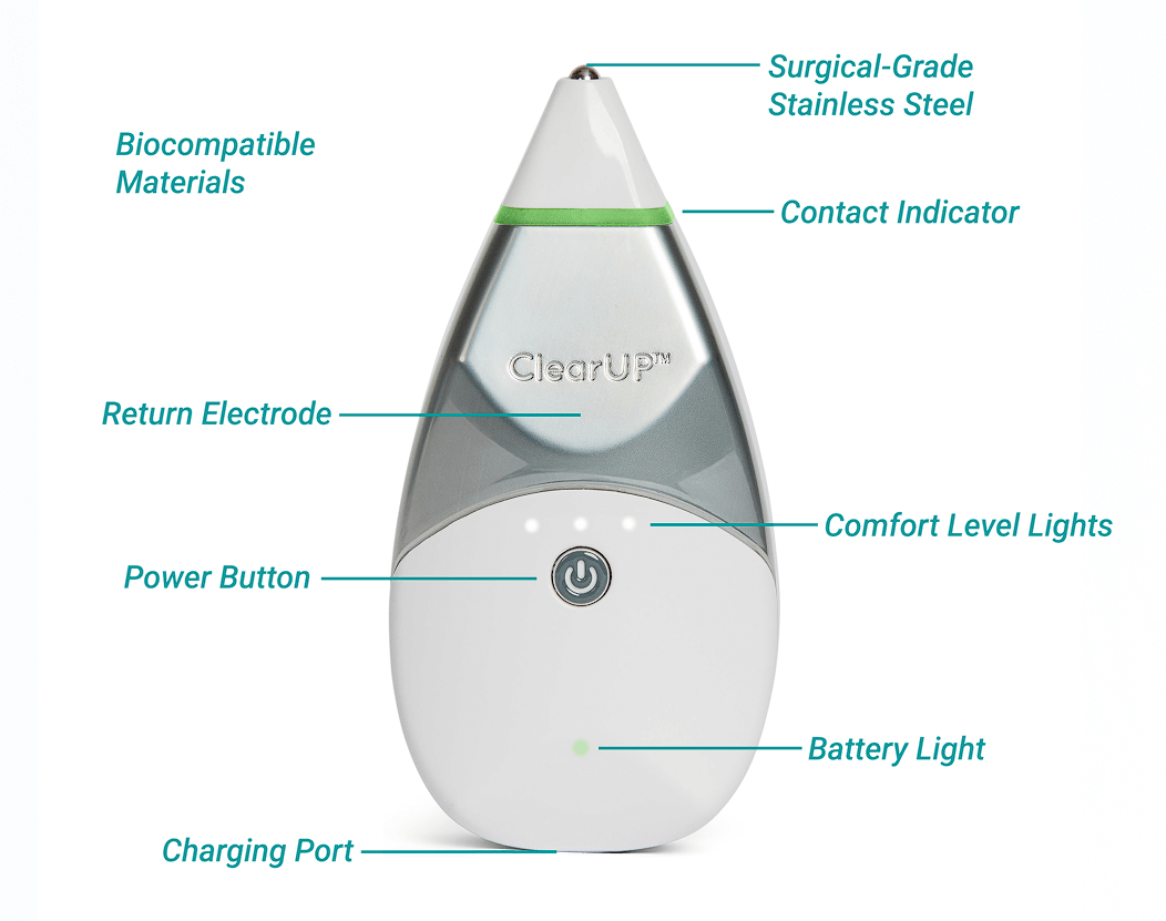 Product features diagram